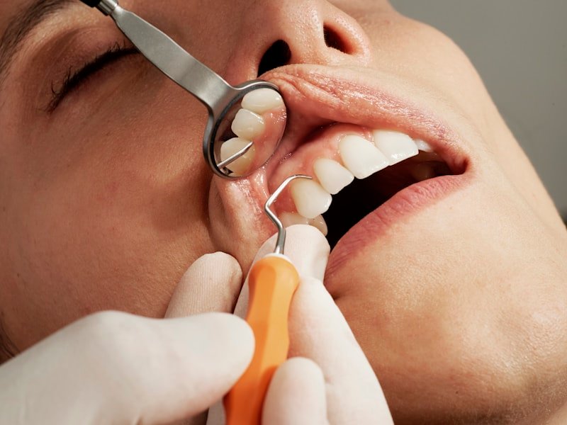 Dentist placing a tooth-coloured filling for a patient