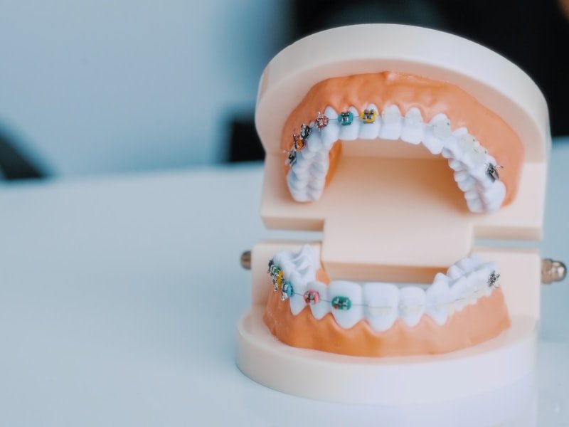 Dental model showing tooth structure for implants and tooth replacement